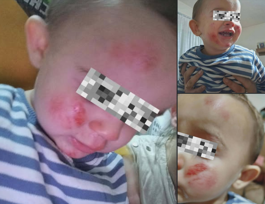 Кучиња нападнале мајка со малолетни деца во кичевско, едното дете има повреди по лицето!